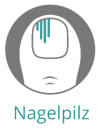 Nagelpilz